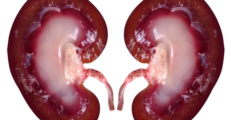 17 amazing foods to keep your kidney healthy natural food series